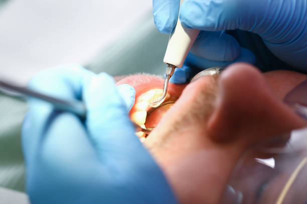 Best Orthodontic Emergency Dentist in Doraville, GA