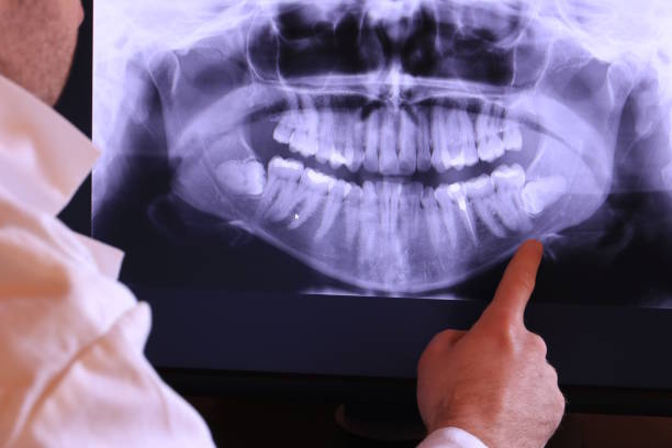 Best Emergency Dental Extractions in Doraville, GA