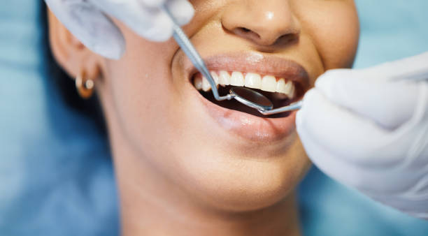 Best Emergency Dental Care for Abscessed Tooth in Doraville, GA